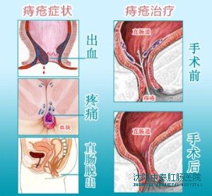 大连春柳中医肛肠医院