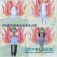 大连春柳中医肛肠医院